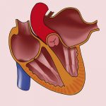 Read more about the article Atrial Abnormality