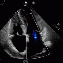 Mr Case Cardio Guide