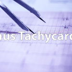 Read more about the article Sinus Tachycardia