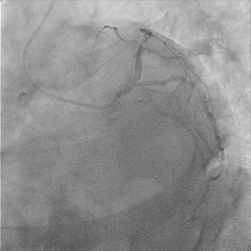 Search Videos Cardio Guide