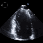 Read more about the article 14 RVF A2C LV