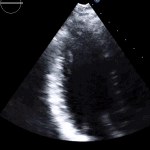 Read more about the article 15 RVF A3C LV